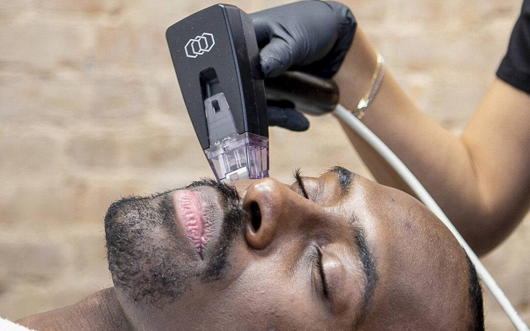 Meet Maha: The Marvels of Morpheus8 at SkinLab NYC