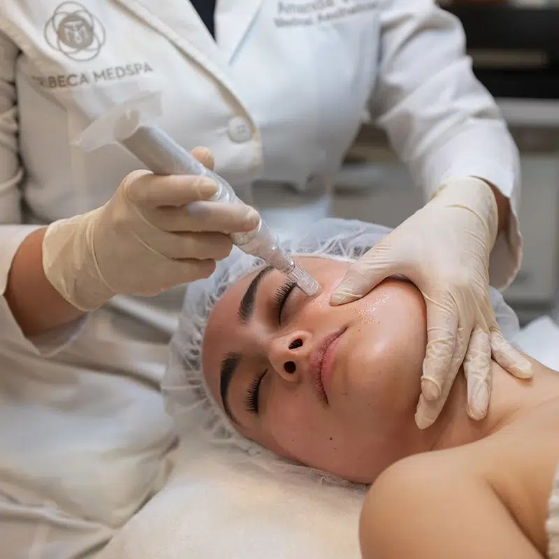 microneedling skincare treatment