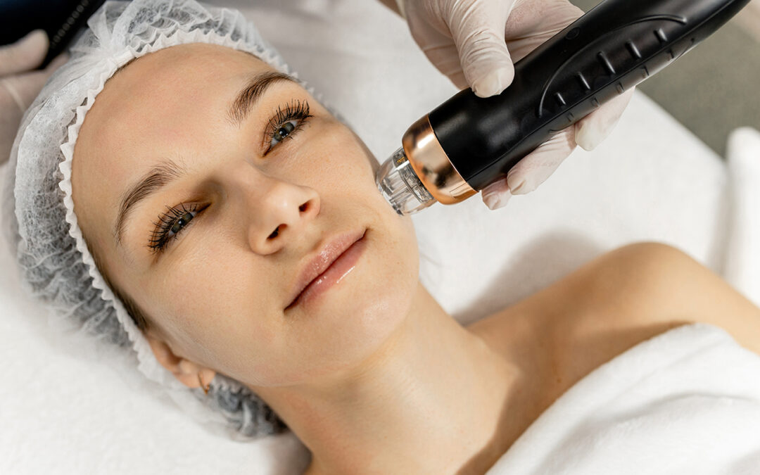 RF Microneedling Alternatives in NYC: How to Build Collagen Safely and Effectively